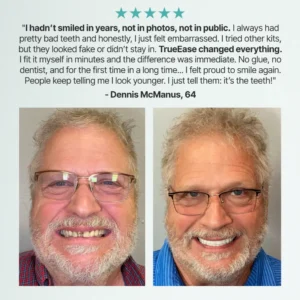 TrueEase™ Custom-Fit Full Functional Dentures